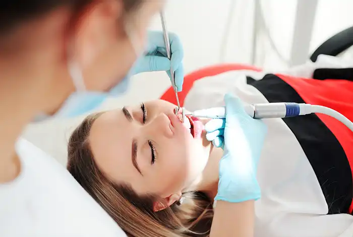 Dental Fillings